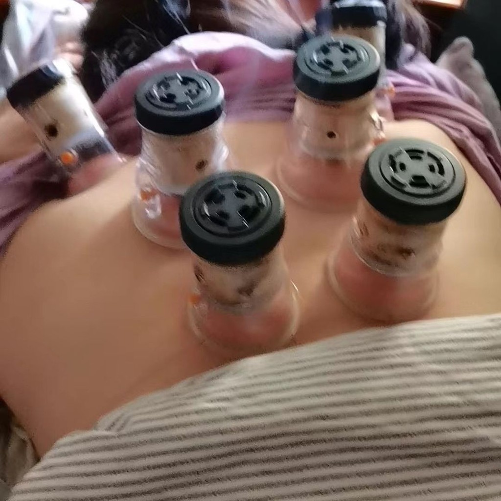 真空拔罐器 氣罐艾灸拔罐一件式罐 拔火罐家用套中醫祛溼寒美容院專用
