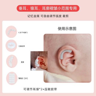 潮款！速發！耳朵矯正器嬰兒新生兒的矯形器招風耳寶寶定型神器糾正垂耳貼耳廓Ear orthotics for infant