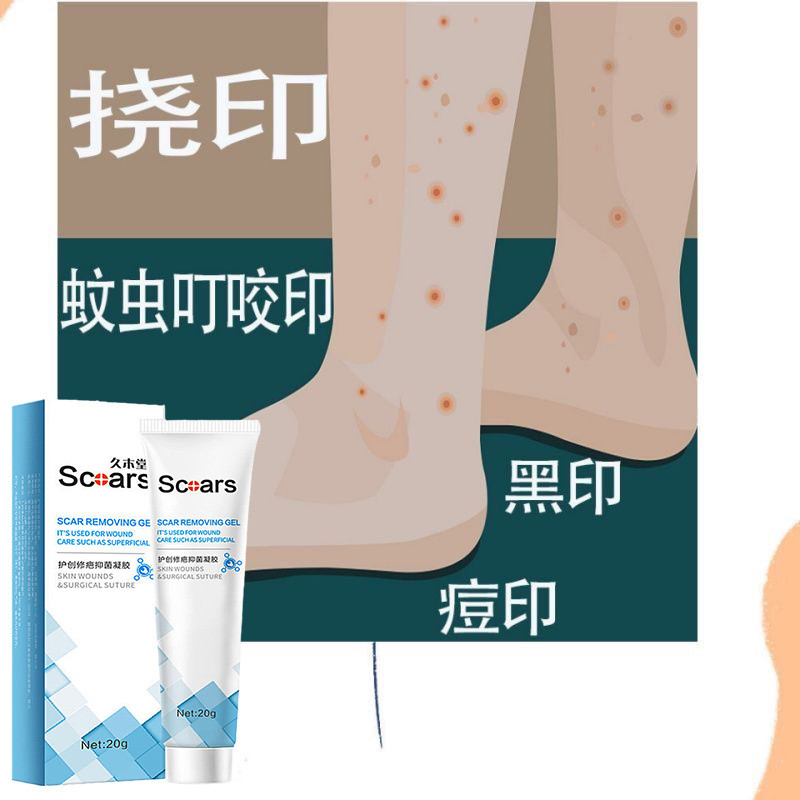 去蚊子叮咬疤印淡化疤痕黑色素沉澱黑印膏祛腿上黑印修復腿印撓印/5.24