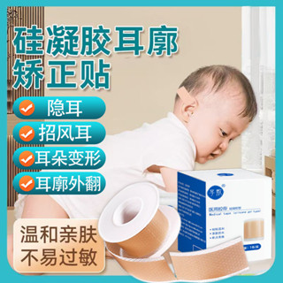耳朵矯正器嬰兒新生的兒垂耳糾正定型招風耳廓矽膠貼兒童寶寶神器//6.7