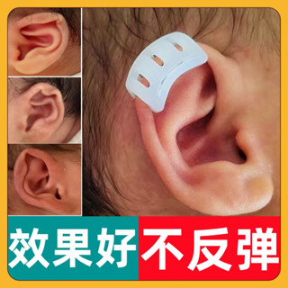 嬰兒耳朵矯正器外翻招風耳初生兒新生兒畸形耳型垂耳定型糾正神器/6.10