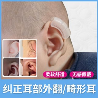 潮款!速發!耳朵矯正器嬰兒兒童耳夾招風垂固定貼矽膠帶夾子寶寶新生兒耳朵矯正器嬰兒耳套兒童耳夾gm
