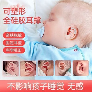 潮款!速發!矽膠嬰兒耳朵矯正器耳廓矯正器耳朵矯正器新生兒耳廓矯正器