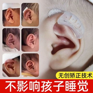潮款！速發！耳朵矯正器嬰兒耳廓固定貼招風耳糾正神器新生的寶寶耳垂定型矽膠Ear corrector, infant ea