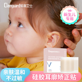 耳朵矯正器寶寶耳廓矽膠貼耳廓定型矽膠貼兒童嬰兒耳道矯正器新生兒透氣耳道矽膠20250606