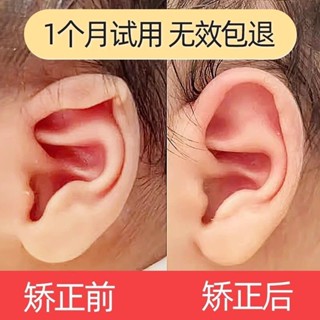 潮款！速發！新生兒耳朵矯正器耳朵矯正器嬰兒貼耳廓貼糾正塑形耳輪定型牽引Newborn ear corrector, in