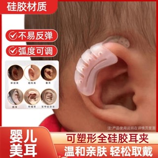 新生兒矽膠耳朵矯正器內建矯形嬰兒畸形耳廓耳型垂耳糾正定型神器Newborn silicone ear corrector