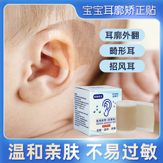 嬰兒耳朵矯正器垂耳廓定型兒童寶寶耳廓定型器掛耳矯正器新生兒耳廓矯正器20250606