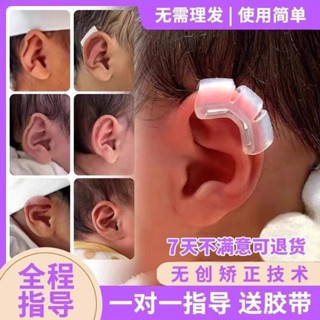 新生兒耳朵矯正器嬰兒寶寶兒童耳廓塑形耳夾矽膠耳撐外耳定型耳貼//6.7