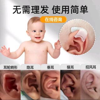 矽膠嬰兒耳朵矯正器耳廓矯形新生兒畸形耳型垂耳糾正定型神器膠捲