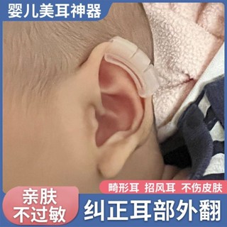 潮款!速發!寶寶耳朵矯正器嬰兒幼童耳定型器外耳風耳貼垂耳器新生兒耳朵矯正器,嬰幼兒護耳器gm