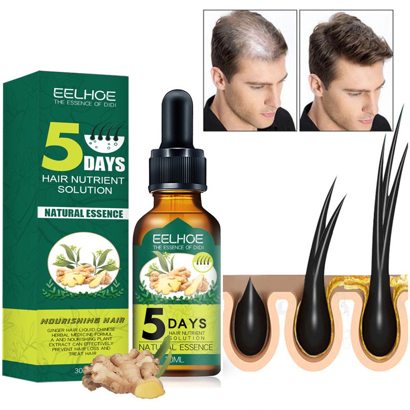 5 天生薑生髮產品精油快速防止稀疏毛躁頭皮治療男士女士