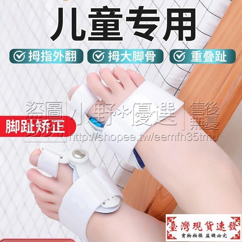 【免運】（34-35鞋碼範圍使用）兒童腳趾矯正器拇外翻拇指分趾器小孩大母足大腳骨矯形器糾正神器 3PBT