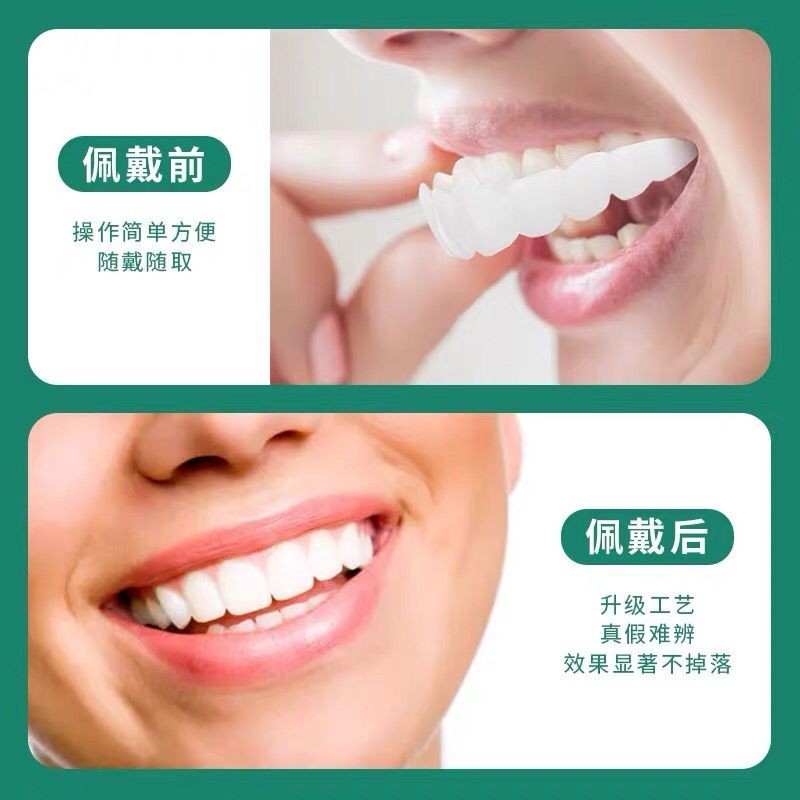 🔥台湾牙耗🔥牙套吃飯神器 通用老人仿真美白假牙遮蓋補牙洞缺牙蛀牙臨時補牙套