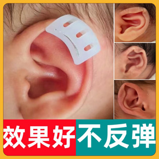 嬰兒耳朵矯正器定型耳廓耳撐精靈耳0到1歲寶寶塑形耳朵固定糾正貼/2.18
