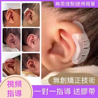 內建嬰兒耳朵矯形器 小兒矯正貼耳廓矯正貼 嬰兒耳廓矯正器寶寶耳朵定型貼招風耳塑形新生兒矽膠帶耳畸形耳撐