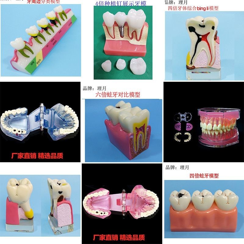 牙齒模型 口腔教學模型 牙模 正畸 修復 種植牙 牙科模型 牙模型牙齒模型 口腔教學模型 牙模 正畸 修復 種植牙 牙科