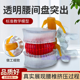 【新貨來了】*模擬腰椎模型 椎間盤 1:1人體骨骼脊柱脊椎解剖/教學骨架標本