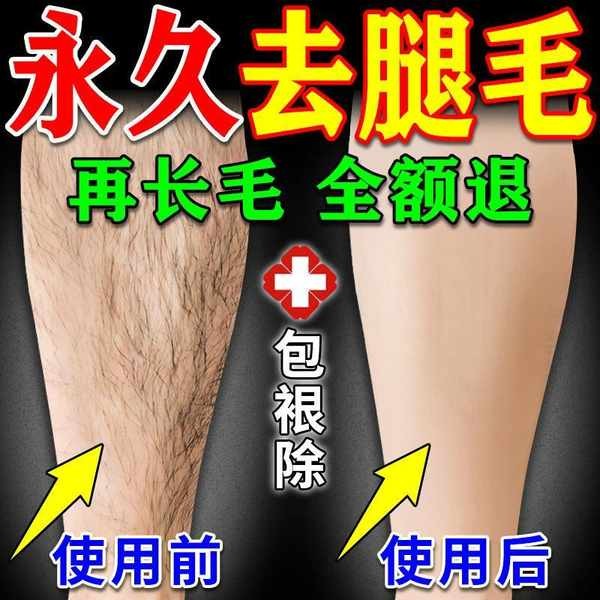 腋下除毛膏 除毛膏 私密除毛膏 腿毛祛除男脫毛膏男士腿毛旺盛去胸腋毛肛毛脫毛膏永久男腿毛神器