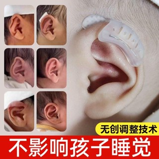 矽膠膠帶醫用膠布寶寶耳朵矯正器嬰兒耳廓固定貼招風耳耳垂定型貼