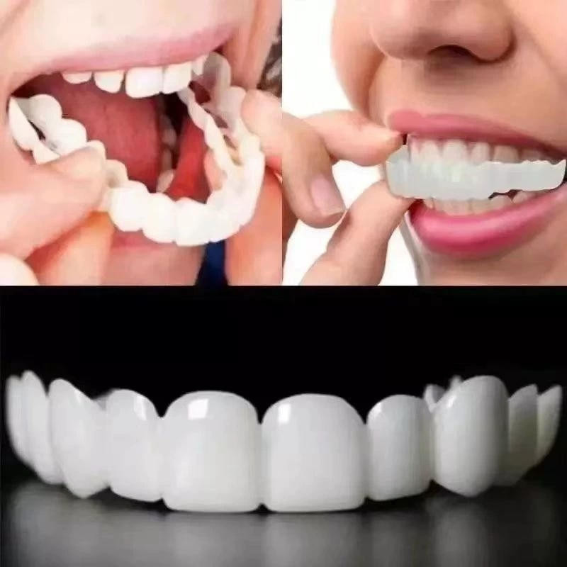牙套 假牙 牙縫隙大假牙套牙 仿真假牙 齒牙縫填充神器 門牙縫矯正器 大齙牙牙套