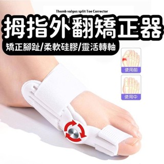 拇指外翻 腳趾矯正器 足部保養 腳趾保護套 分趾器 拇指外翻效正器 拇指外翻矯正器 分趾襪 拇指外翻襪 拇指外翻矯正