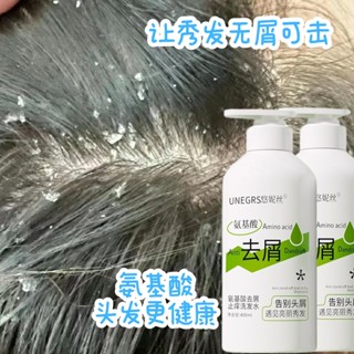 抗屑洗髮精 止癢洗髮精 控油洗髮精 400ml 洗髮精 柔順 洗髮水 蓬鬆 洗髮乳 秀髮護理 防髮絲分叉 MWMT