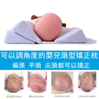 【可開票】寶寶頭型矯正 頭部矯正器 嬰兒枕頭防偏頭定型枕 寶寶頭型枕 嬰兒矯正枕頭 嬰兒定型枕 嬰兒矯正枕頭