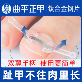 【臺灣出貨】 曲平 甲溝嵌 甲矯正器 正甲貼片 腳趾 甲蓋內嵌神器 固定炎指甲