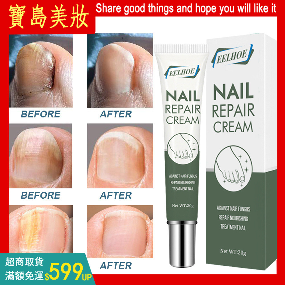 【EELHOE指甲修護凝膠】NAIL Repair cream指甲修護指甲護理膏指甲凝膠20g 甲修護指甲護理膏指甲保養