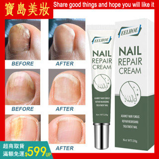 【EELHOE指甲修護凝膠】NAIL Repair cream指甲修護指甲護理膏指甲凝膠20g 甲修護指甲護理膏指甲保養