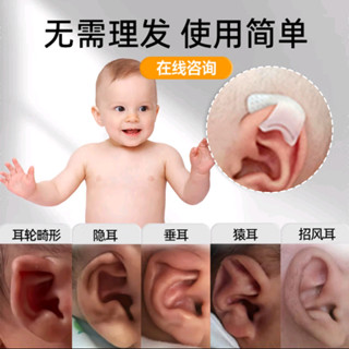 矽膠嬰兒耳朵矯正器耳朵矯正器耳廓變形器新生兒耳廓定型神器膠卷矽膠嬰兒耳朵矯正器 aancc7405dys.my20250