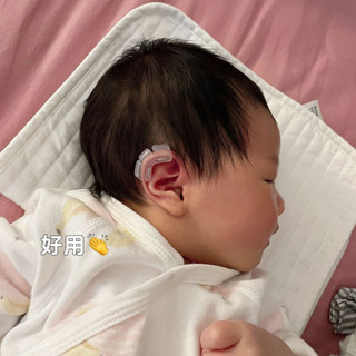 新生兒耳朵矯正器耳朵矯正器嬰兒貼寶寶耳廓貼塑形耳輪定型牽引器[jiao]