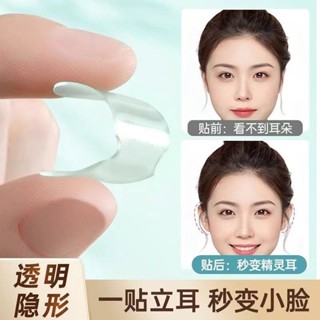 【有幸時光】直播神器 耳貼 隱形耳貼 升級精靈立耳貼 防水耳貼 定型耳朵支撐器 顯臉小神器耳貼 變招風耳耳貼 熱銷款