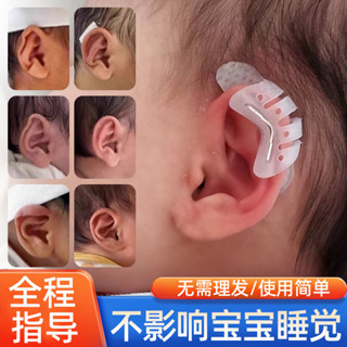 [睡眠無憂]矽膠嬰兒耳朵矯正器耳廓矯形新生兒畸形耳型垂耳糾正[mxw]