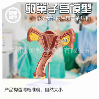 女性病理子宮模型 模擬病態子宮模型 敎學模型 人體器官玩具 人體器官拚圖
