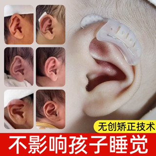 ✨7645人好評矽膠嬰兒耳朵矯正器耳廓矯形新生兒畸形耳型垂耳糾正定型神器膠捲25.05.08