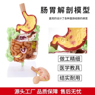 胃解剖 大腸 盲腸 直腸 十二指腸 消化係統模型 敎學模型 人體器官玩具 人體器官拚圖