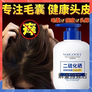 【3天出貨】抖音爆款 二硫化硒去屑止癢洗髮精 控油 清爽 去屑 止癢 去頭油 控油洗髮精 去屑洗髮精 頭皮洗髮精 洗髮水