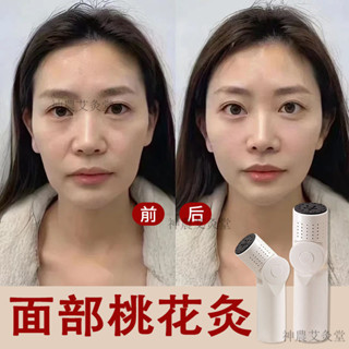 面部桃花灸罐艾灸棒臉部按摩專用溫灸儀美容儀器具神器無煙艾灸