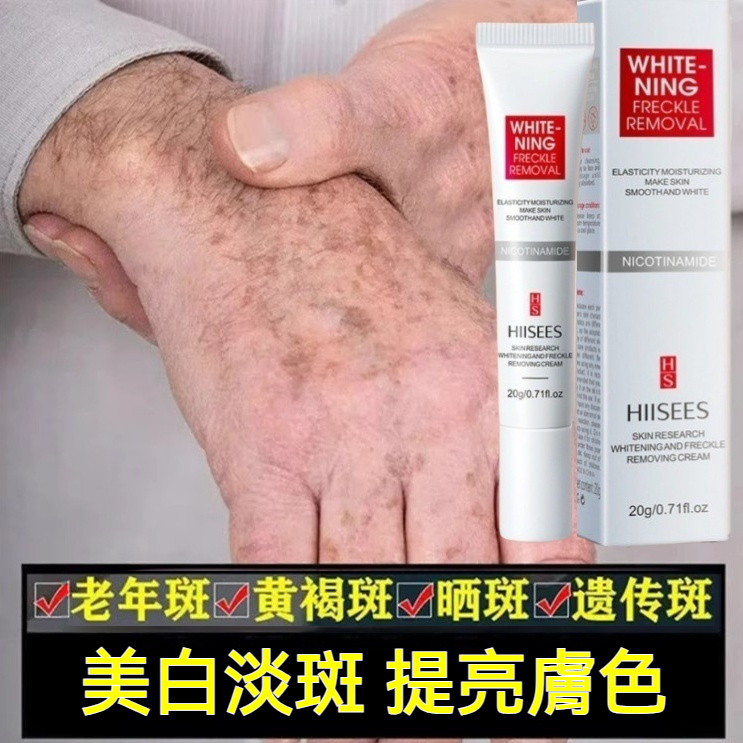 高雄出貨【熱銷】淡/斑霜 老人斑 雀斑 斑點 黃褐斑 曬斑 黑色素 黑斑 毛孔 發黃 美容養顏 遠離黃氣 素顏神器