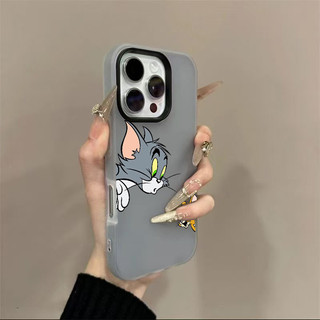 貓和老鼠 一加手機殼 ONEPLUS NORD 3 2 N30 N20 CE2 CE3 CE4 LITE 保護殼