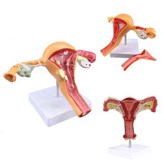 醫學教具 子宮 卵巢病理病變模型 女性子宮陰道模型 生殖器官結構解剖教學用具