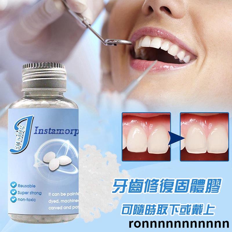 【熱銷】臨時假牙 補牙樹脂 補缺牙齒 自己補牙 縫義齒 牙套牙洞材料 假牙材料