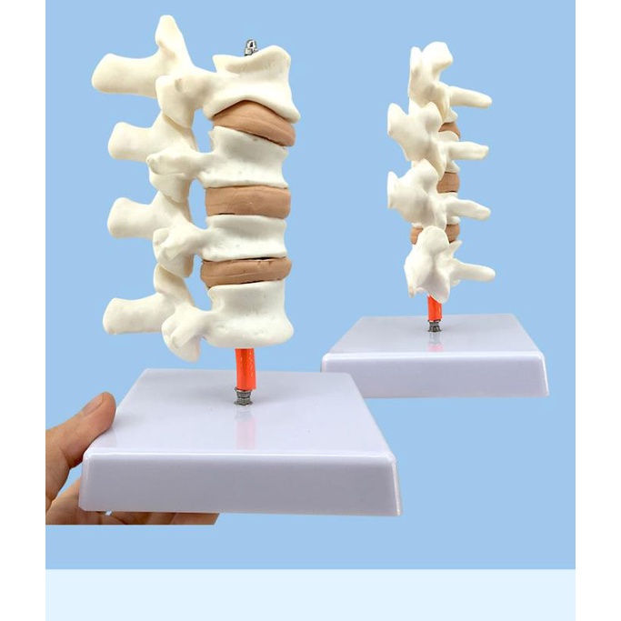 ❀0382❀人體骨骼 骨質疏松病變模型 脊椎頸椎解刨模型 關節模型骨骼模型