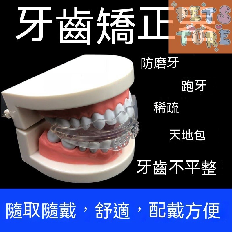 【Petstore】4D牙齒矯正器 透明隱形牙套 成人 兒童 夜間防磨 齙牙糾正器 整牙保持器 牙齒矯正器 隱形牙套