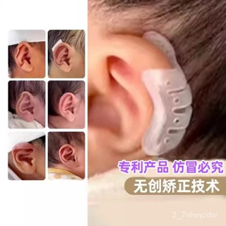 【免運🔥優選】矽膠嬰兒耳朵矯正器耳廓矯形新生兒畸形耳型垂耳糾正定型神器膠捲