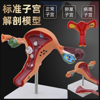 人體女性生殖子宮解剖病理模型 陰道卵巢教學模型 婦科生殖科教具[qo97]