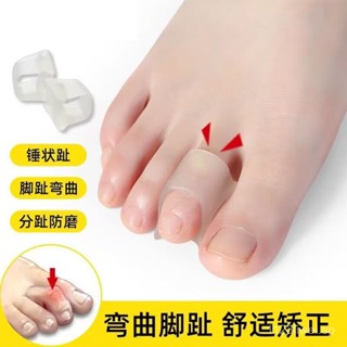 【臺灣熱賣】腳趾矯正器 醫用腳趾矯正器錘狀彎曲矯正器兒童成人腳趾套腳趾變形矯正器分趾