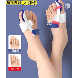 【拇指外翻 矯正器】臺灣現貨 夜用加強款 姆指外翻 拉力訓練帶 大腳趾 分離器 槓桿原理 分趾 腳趾 重疊足趾 護理